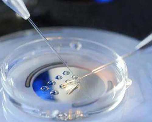 育儿教育书籍_育儿书籍,高龄备孕,三项检查不能少:优质的卵子、畅通的输卵