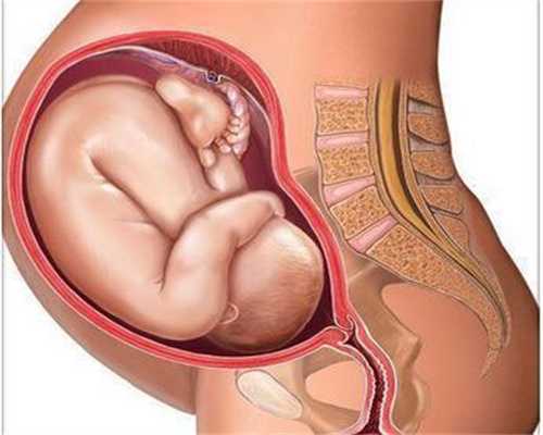 aa69助孕公司官网：泰国试管婴儿会受附睾炎影响吗？
